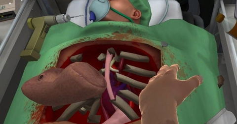Surgeon Simulator, el simulador de operaciones más entretenido aparece por fin en Android