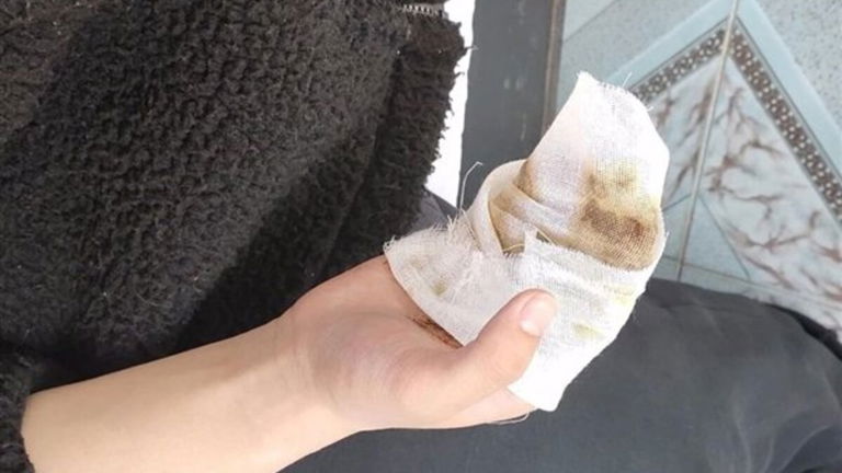 Así es como pueden explotar unos auriculares de 200 euros (spoiler: siendo muy torpe)