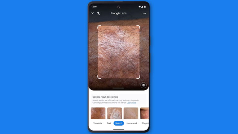 Google Lens ahora puede detectar enfermedades en tu piel usando la cámara del móvil