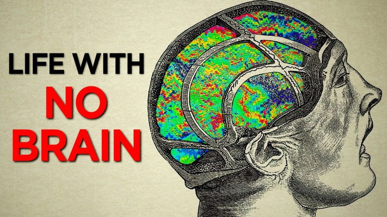 Este hombre vivió sin cerebro, pero no fue un milagro, fue ciencia