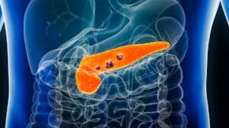 Han descubierto una nueva vacuna para el cáncer de páncreas: es prometedora
