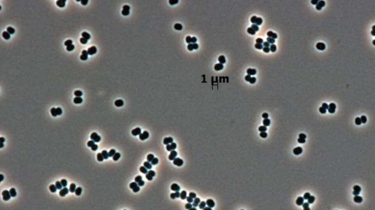 Así es la superbacteria que se infiltró en la NASA y que muy posiblemente hayamos enviado sin querer a Marte